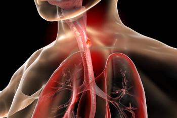 Subgroup data from RATIONALE-306 support the frontline use of tislelizumab plus chemotherapy in locally advanced esophageal squamous cell carcinoma.