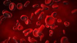 Reduction in Transfusion Dependency Observed With Low-Dose Lenalidomide for Myelodysplastic Syndrome