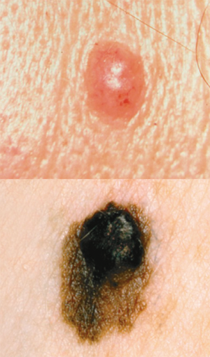 web based course improved physician skin cancer skills