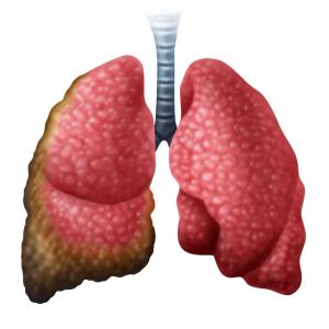 An ongoing, open-label phase 1 study evaluating VT3989 in mesothelioma revealed positive early efficacy and encouraging safety with the agent.