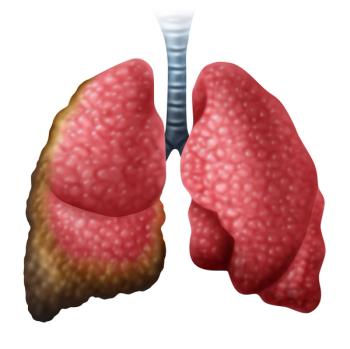 An ongoing, open-label phase 1 study evaluating VT3989 in mesothelioma revealed positive early efficacy and encouraging safety with the agent.