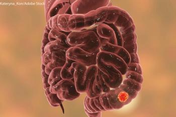 Tucatinib/Trastuzumab Yields Durable Responses in HER2+ Metastatic CRC | Image Credit: © Kateryna_Kon - stock.adobe.com.