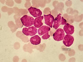 AML, leukemia, blood cancer