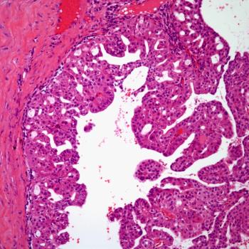 PYX-201 is currently being investigated in a phase 1 trial in patients with solid tumors.