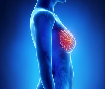 Long-term follow-up data continue to show that patients with lymph node–positive, HER2-positive early breast cancer at a high risk of recurrence derived notable, durable benefit from treatment with adjuvant pertuzumab, trastuzumab, and chemotherapy. 