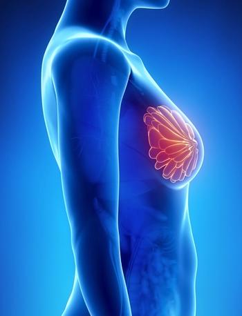 Long-term follow-up data continue to show that patients with lymph node–positive, HER2-positive early breast cancer at a high risk of recurrence derived notable, durable benefit from treatment with adjuvant pertuzumab, trastuzumab, and chemotherapy.