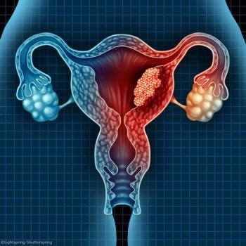 Endometrial cancer markers for earlier diagnosis 