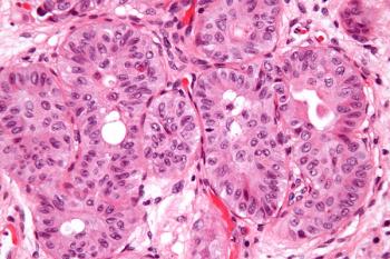 Extended follow-up findings further support the use of nivolumab as a standard of care in high-risk muscle-invasive urothelial carcinoma following radical resection.