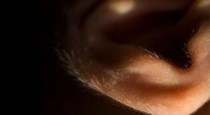 A 54-Year-Old Woman Notes the Abundant Development of Nonpigmented Hair on Her Ears and Nose