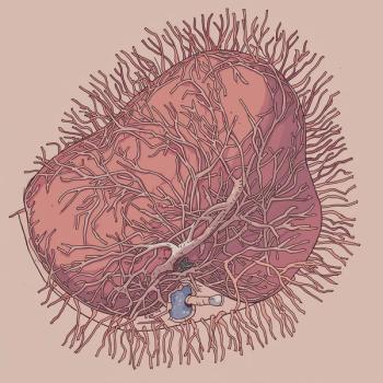 Zolucatetide yielded a DCR of 100% and ORR of 80% among patients with secretase-naïve and secretase-treated desmoid tumors. 