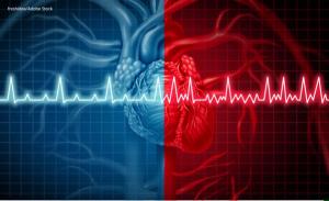 Link Found Between Atrial Fibrillation, Chemotherapy Treatment for Early-Stage Breast Cancer