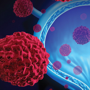 Erdafitinib in the Treatment of Metastatic Urothelial Carcinoma