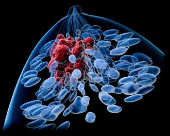 A user-friendly “nudge” may provide a timely reminder to surgeons to consider the value of sentinel lymph node biopsy in older patients with breast cancer.