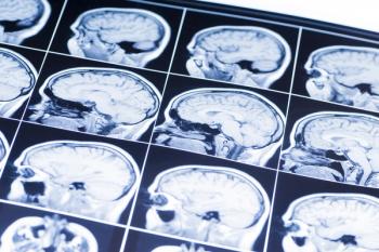 brain scans
