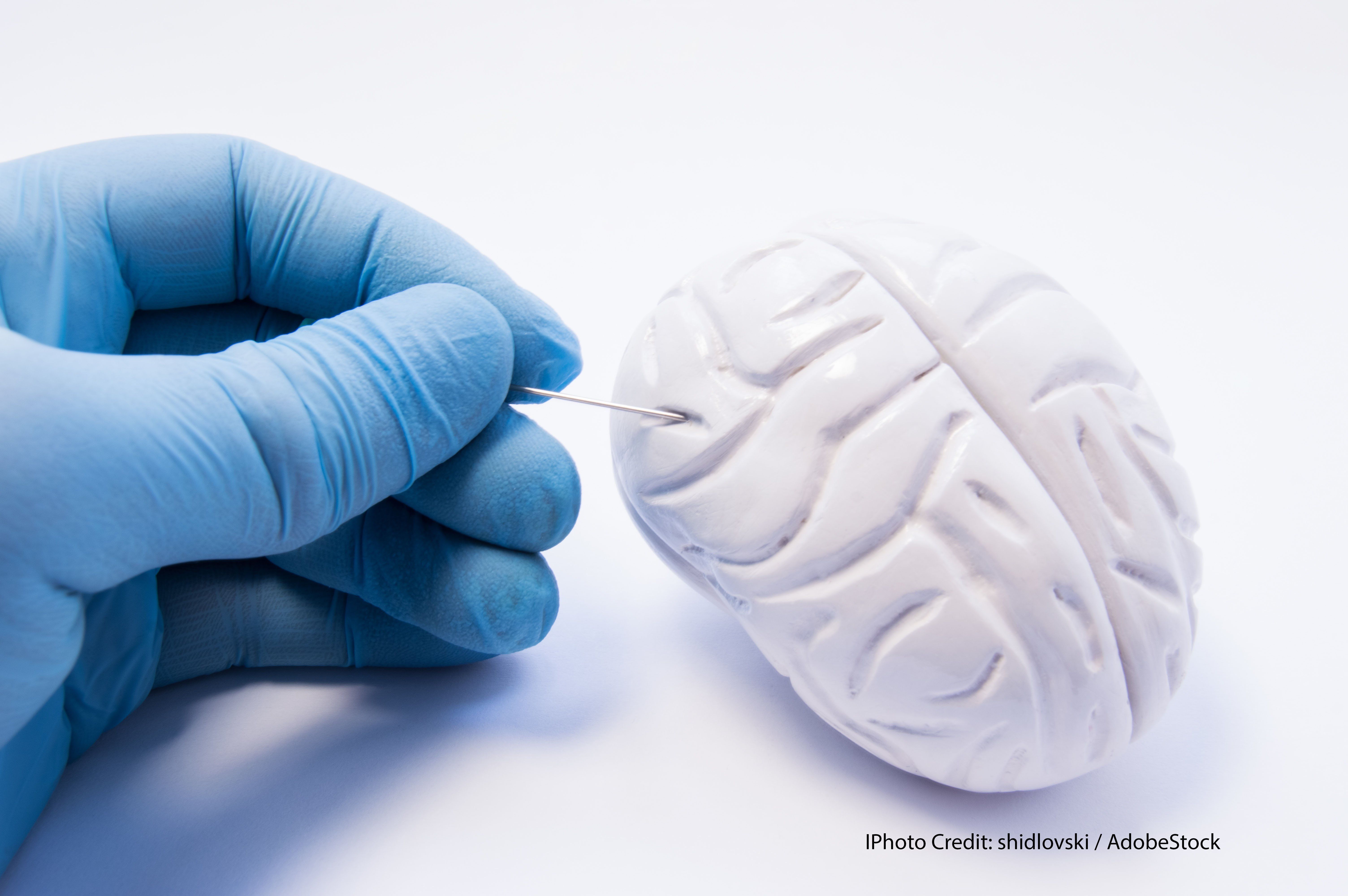 CheckMate 204: New First-Line Therapy for Asymptomatic Melanoma Brain ...