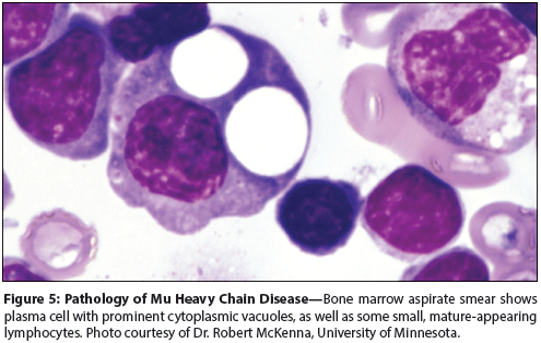 The Heavy Chain Diseases Clinical And Pathologic Features