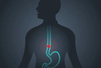 Patients With Esophageal Squamous Cell Carcinoma Treated With Frontline Toripalimab Plus Chemo Derive Survival Benefit