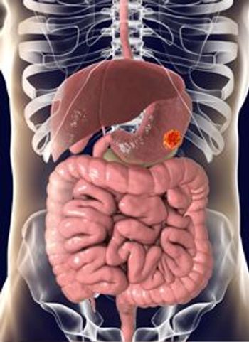 Patients with newly diagnosed, advanced biliary tract cancers do not have a statistically significant survival benefit following treatment with nab-paclitaxel plus gemcitabine and cisplatin.