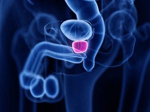 Evaluating HRR and MMR in Advanced Prostate Cancer: © Sebastian Kaulitzki - stock.adobe.com