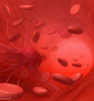 Unmet social needs such as food and housing insecurity should be a consideration for survivors of hematologic cancer, especially those with a lower socioeconomic status or who are of a racial or ethnic minority.