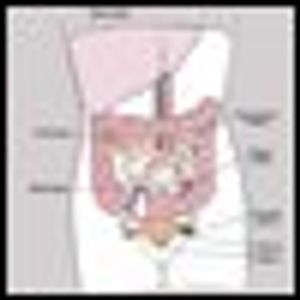 21st Century Challenge of Ovarian Cancer in the Elderly