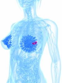 Data from the PANKU-Breast02 trial may support iza-bren as a new standard of care in this TNBC population.