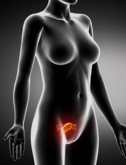 Early Findings Indicate Vistusertib Plus Anastrozole Improved Survival in HR+ Advanced Endometrial Cancer