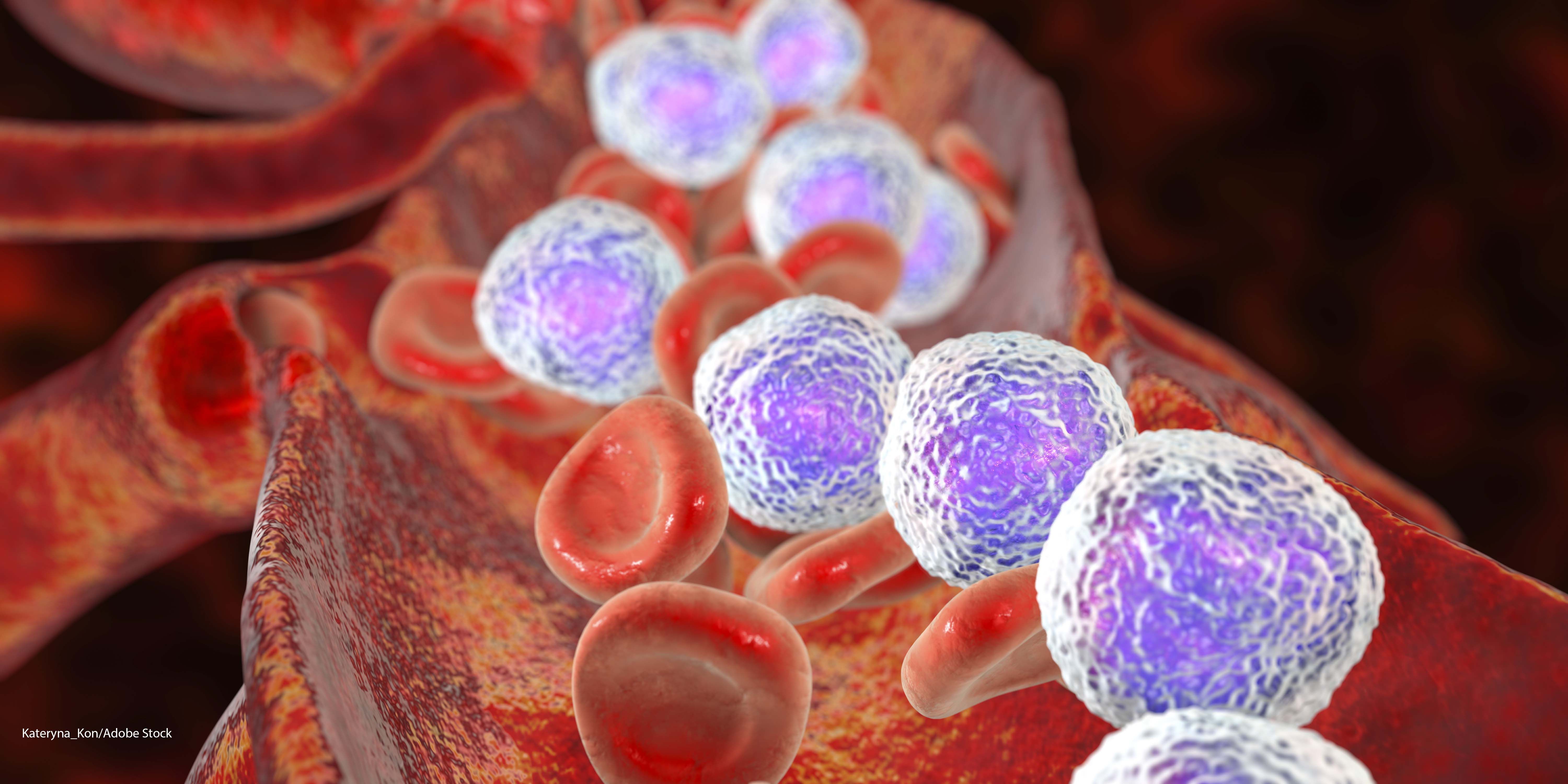 Defining the Landscape of Mutations Present in Pediatric Acute