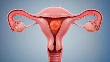 The gynecologic oncology data to watch at ESMO 2026: © Jenjira - stock.adobe.com