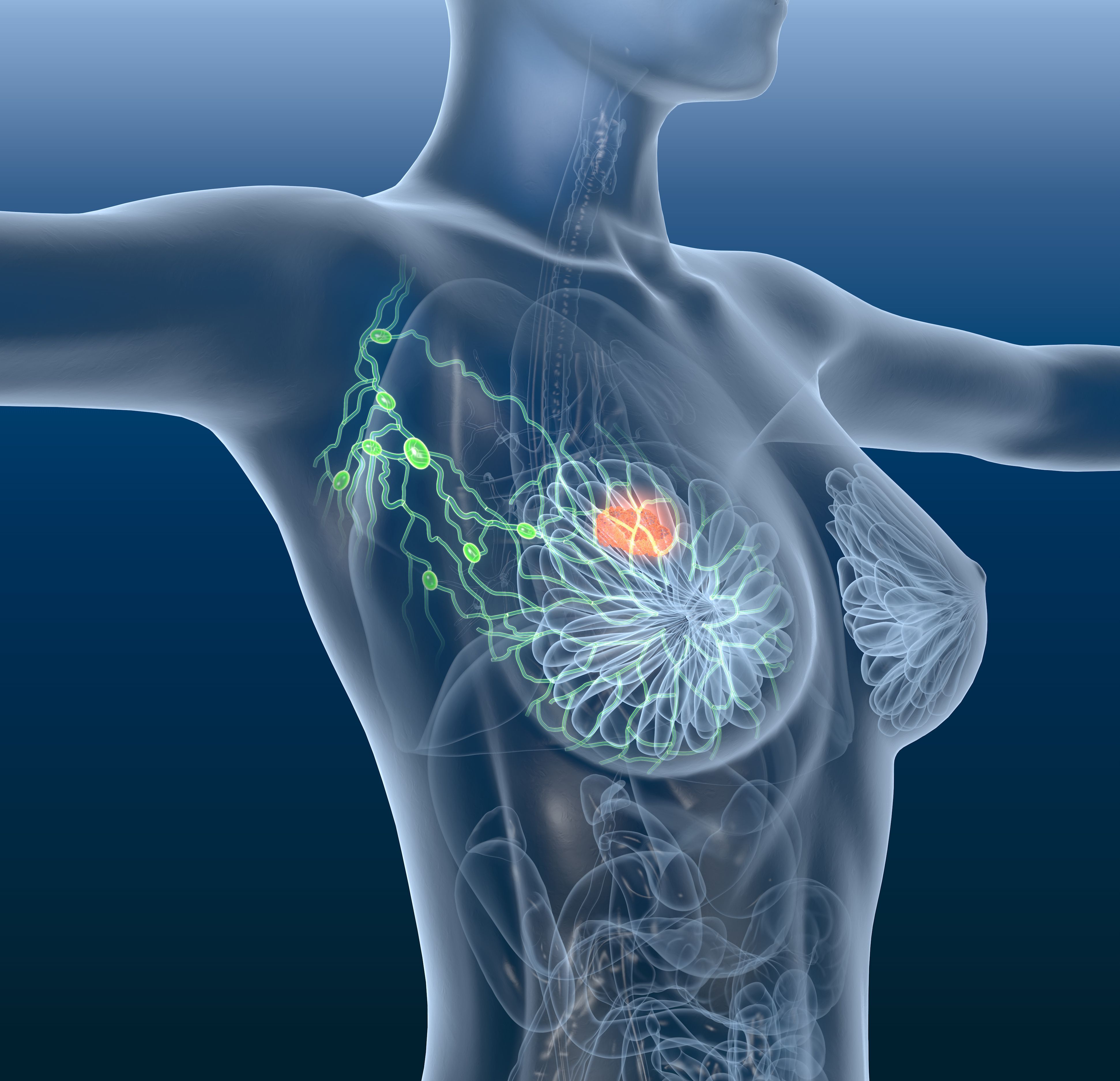 Data Collection Method for Benign Breast Disease Can Provide Insight on