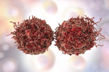 Prostate Cancer