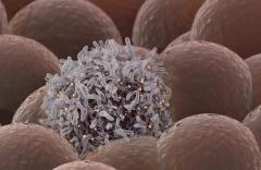 EP. 9 Nivolumab Combinations Show Best Treatment Options for Advanced Melanoma