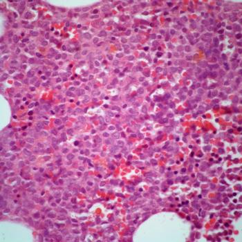 The experimental agent appears tolerable in patients with relapsed or refractory FLT3-mutated acute myeloid leukemia in a phase 1b trial.