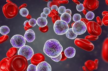 DLBCL