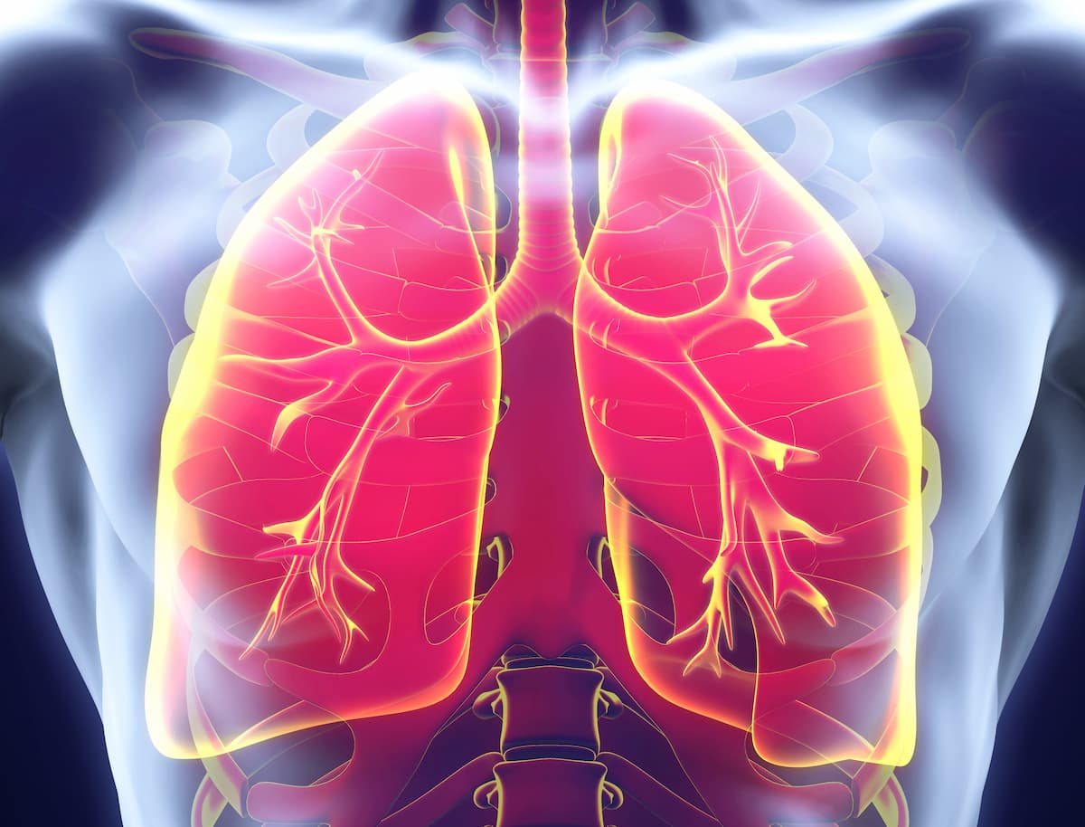 Zongertinib Yields Meaningful Responses in Pretreated HER2 Mutated NSCLC Zongertinib Yields Meaningful Responses in Pretreated HER2 Mutated NSCLC
