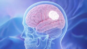Adjuvant Radiotherapy Reduced Recurrence in Resected Atypical Meningioma: © 程 加星 - stock.adobe.com