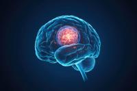 FDA Grants Fast Track Designation to Safusidenib in IDH1-Mutant Glioma: © mat - stock.adobe.com