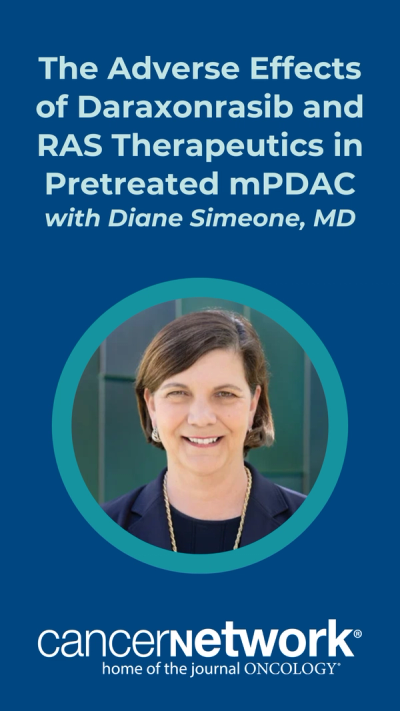Diane Simeone, MD, spoke about findings with daraxonrasib in metastatic pretreated pancreatic cancer during an interview with CancerNetwork.