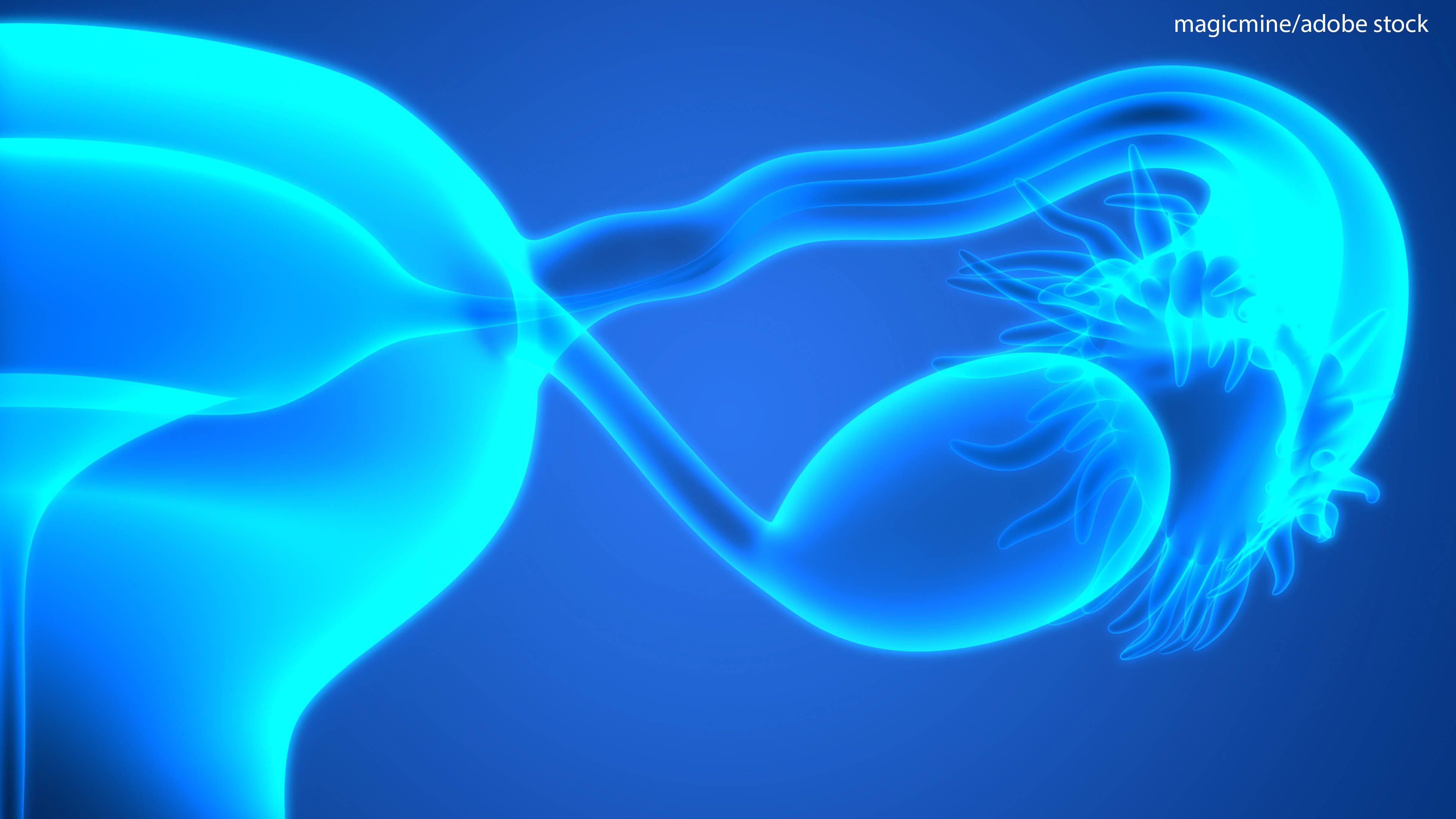 Fuzuloparib monotherapy and as a combination with apatinib improved PFS as maintenance therapy in patients with ovarian cancer harboring BRCA1/2 mutations.