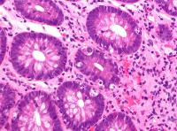 Across all dose levels of axatilimab, the 46-month OS rate was the 74.1% among patients with previously treated chronic graft-vs-host disease.
