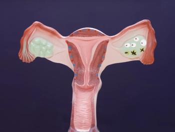 Socioeconomic or racial disparities may contribute to unchanged overall survival among certain patients with metastatic uterine cancer.