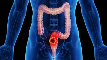 Dostarlimab Yields Complete Responses in dMMR/MSI-H Rectal Cancer: © Sebastian Kaulitzki - stock.adobe.com