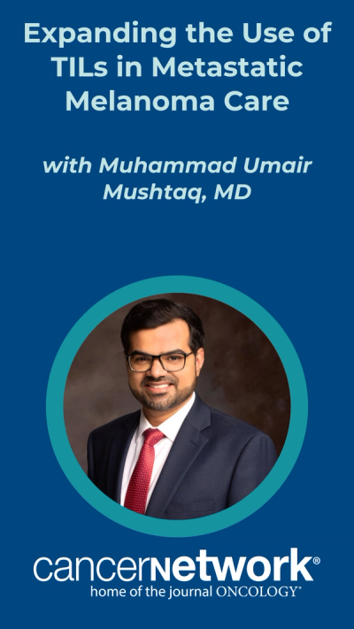 Expanding the Use of TILs in Metastatic Melanoma Care