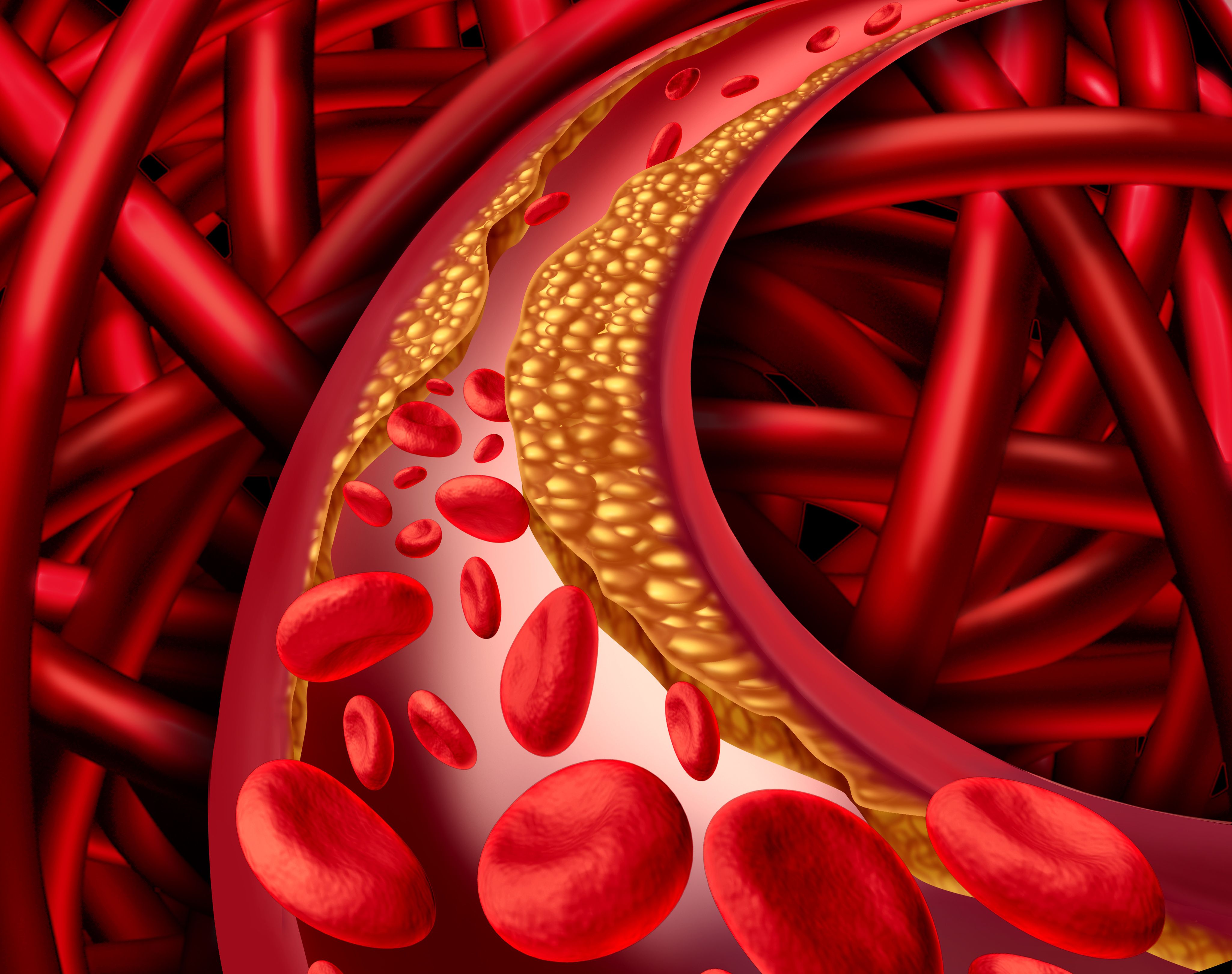 Cholesterol. Холестерин. Стенка здоровой сосуды.