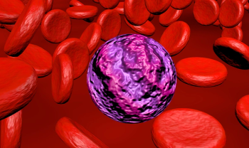 Leukemia