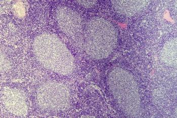 Data from the phase 1/2 EPCORE NHL-1 trial support the FDA breakthrough therapy designation for epcoritamab-bysp in patients with previously treated relapsed/refractory follicular lymphoma.