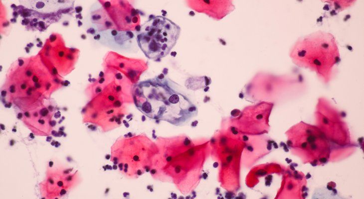 SCREENING FOR CERVICAL CANCER USPSTF visual data 2