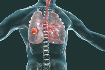 lung cancer