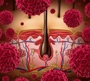 The FDA indicated that data from the phase 1/2 IGNYTE trial were not adequate to provide evidence of effectiveness.