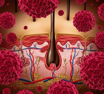 The FDA indicated that data from the phase 1/2 IGNYTE trial were not adequate to provide evidence of effectiveness.